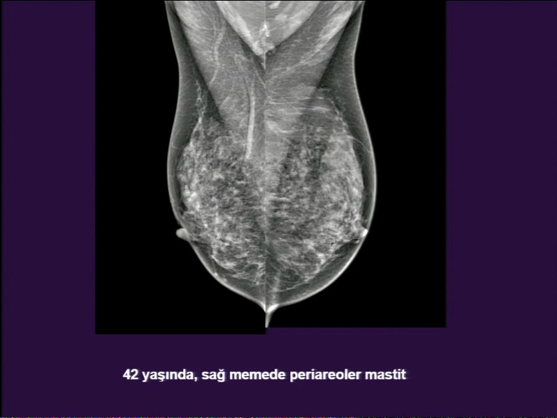 Oziga anal zavq bagishlayotgan erkakning videosini tomosha qiling